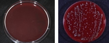 嫌気培養について