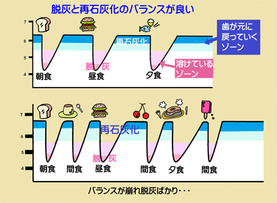 食生活と虫歯の関係について①